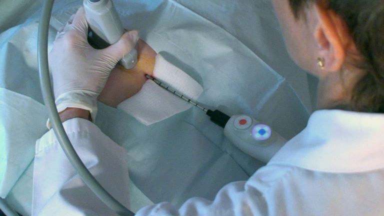 Krioablació a daganatos megbetegedések gyógyításában